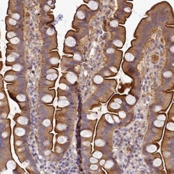 TMEM74B Antibody, Novus Biologicals 0.1mL; Unlabeled:Antibodies, Polyclonal